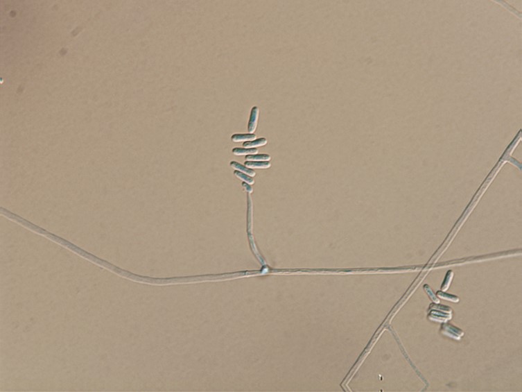 Cordyceps chiangdaoensis